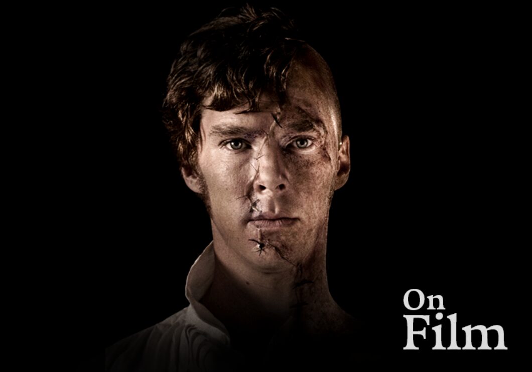 Benedict Cumberbatch in Frankenstein. His face is stitched up.